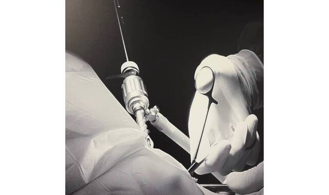 De mogelijkheden van laparoscopie